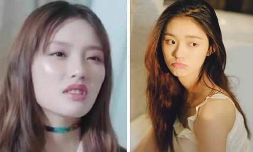 林允回应脸型变化整容了吗：网曝林允整容林允回应了