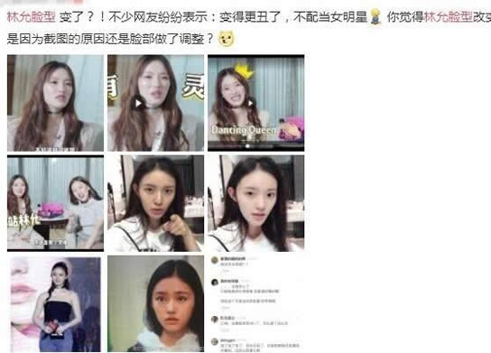 林允回应脸型变化整容了吗：网曝林允整容林允回应了