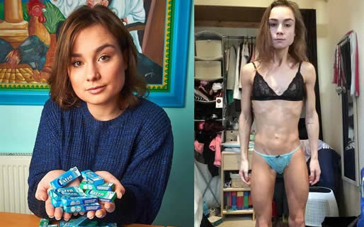 日嚼1万片口香糖是什么情况：减肥不能忽视健康问题