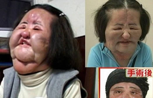 电风扇阿姨去世曝光昔日靓照：揭其整容全过程（图）