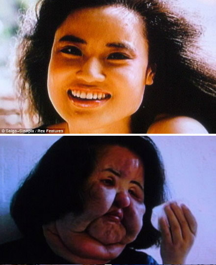 电风扇阿姨去世曝光昔日靓照：揭其整容全过程（图）