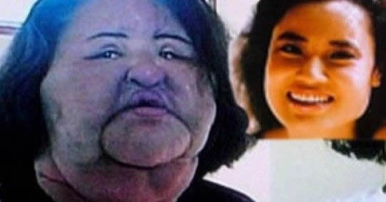 电风扇阿姨去世曝光昔日靓照：揭其整容全过程（图）