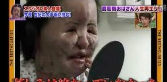 电风扇阿姨去世曝光昔日靓照：揭其整容全过程（图）