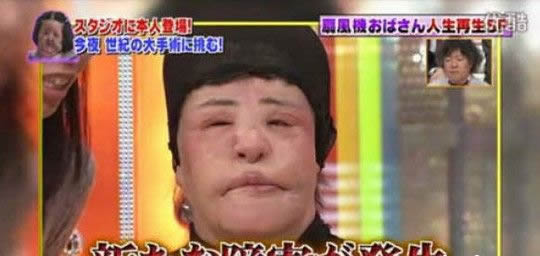 电风扇阿姨去世曝光昔日靓照：揭其整容全过程（图）