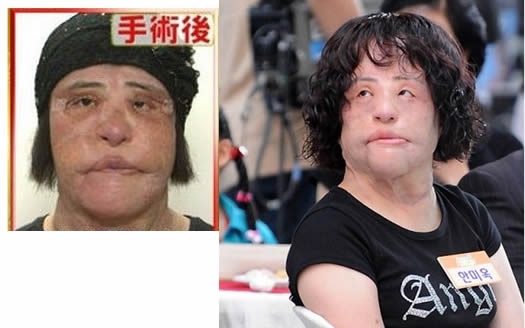 电风扇阿姨去世曝光昔日靓照：揭其整容全过程（图）