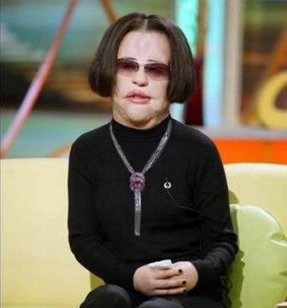 电风扇阿姨去世曝光昔日靓照：揭其整容全过程（图）