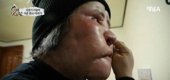 电风扇阿姨去世曝光昔日靓照：揭其整容全过程（图）