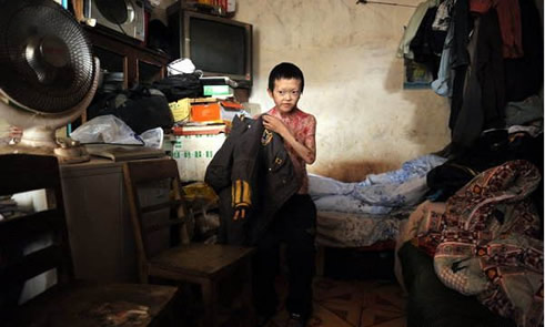 保鲜膜男孩18岁了是什么情况:保鲜膜男孩事件始末 保鲜膜男孩18岁了是什么情况:保鲜膜男孩事件始末