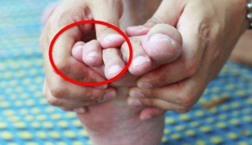 生活中的最大痛苦：?10大日常痛苦瞬间