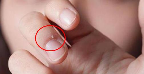 生活中的最大痛苦：?10大日常痛苦瞬间