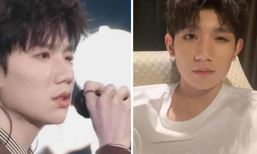 王源回应眼睛被咬具体什么情况:为什么被咬图片曝光 王源回应眼睛被咬具体什么情况:为什么被咬图片曝光