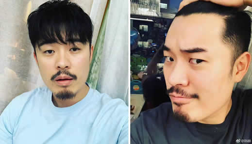 陈赫秃顶指日可待什么情况：为什么说陈赫秃顶指日可待