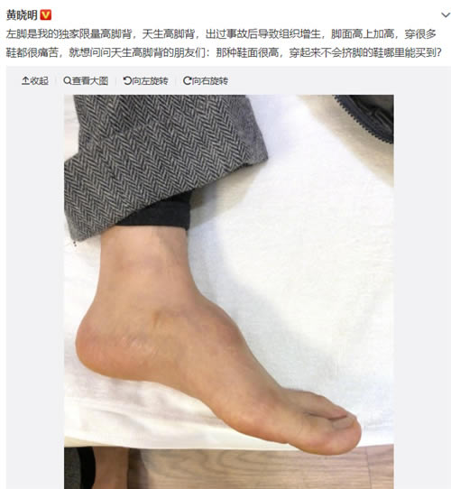 黄晓明增高鞋垫是什么情况：真相让人心疼（图）