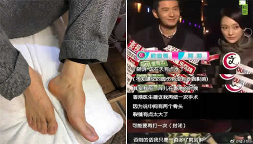 黄晓明增高鞋垫是什么情况：真相让人心疼（图）