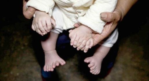 刚出生的宝宝31根指头？真相却让人心疼（罕见图）