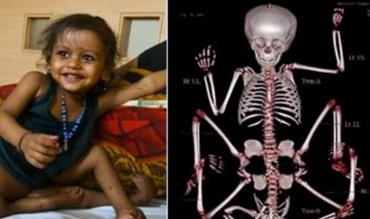 蜘蛛女孩是谁资料简介:蜘蛛女孩日常生活图片 蜘蛛女孩是谁资料简介:蜘蛛女孩日常生活图片