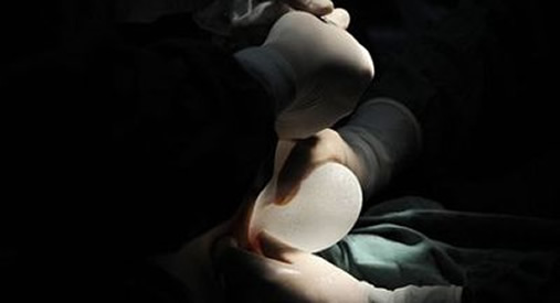 柳州女子隆胸死亡具体什么情况:原因详情全过程 柳州女子隆胸死亡具体什么情况:原因详情全过程