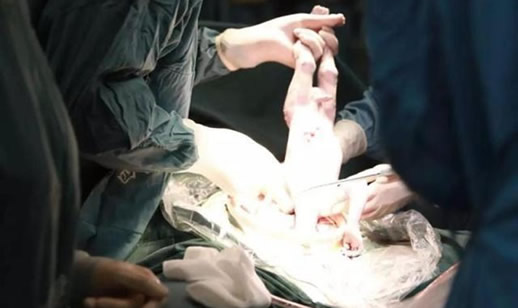 中国首例添宫宝宝是什么情况:这就是真相值得称赞 中国首例添宫宝宝是什么情况:这就是真相值得称赞