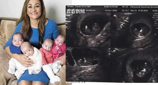 51岁祖母生4胞胎:真相惊呆了(图) 51岁祖母生4胞胎:真相惊呆了(图)