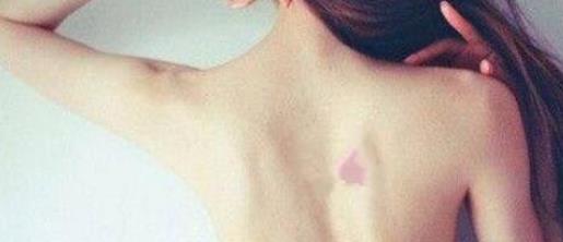 胎记图片解读：10处有福气的胎记图片