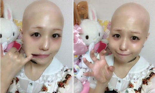 女偶像患脱毛怪病:这位女偶像是谁照片曝光 女偶像患脱毛怪病:这位女偶像是谁照片曝光