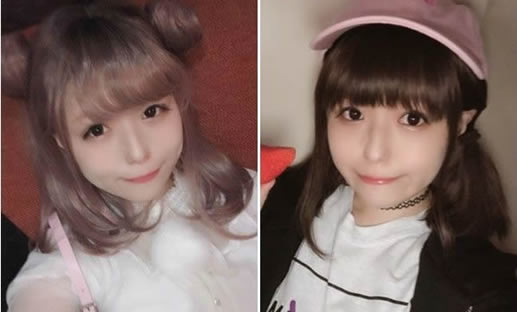 女偶像患脱毛怪病:这位女偶像是谁照片曝光 女偶像患脱毛怪病:这位女偶像是谁照片曝光