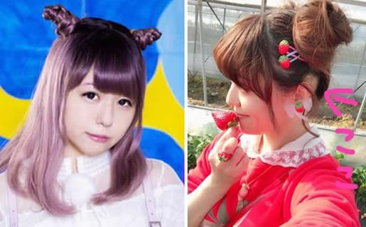 女偶像患脱毛怪病:这位女偶像是谁照片曝光 女偶像患脱毛怪病:这位女偶像是谁照片曝光