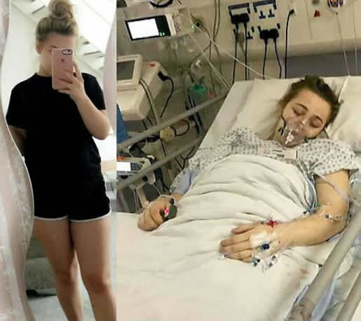 昏迷4天诞下女婴竟不知怀孕:双子宫一个孕育一个维持例假 昏迷4天诞下女婴竟不知怀孕:双子宫一个孕育一个维持例假