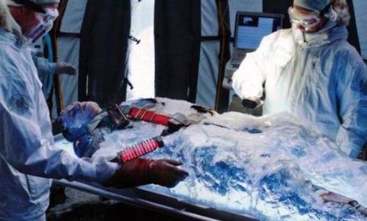 假如把一个人冰冻100年解冻后到底能不能复活（真相这样）