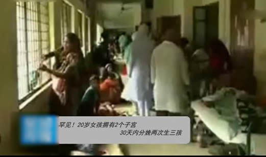 太罕见：女孩拥有2个子宫：这究竟是个什么梗？