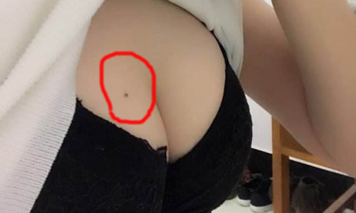 女人10处有痣是富贵痣:女人身体10处有痣不能点掉