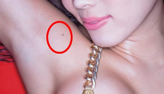 女人10处有痣是富贵痣：女人身体10处有痣不能点掉