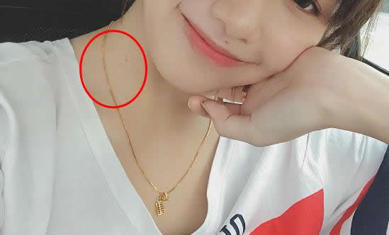 痣是怎么形成的:痣的位置及50种身体痣相解读 痣是怎么形成的:痣的位置及50种身体痣相解读