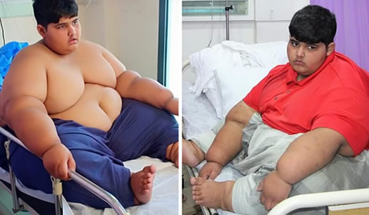 10岁男孩197公斤什么情况:真相详情令人惊讶又无奈 10岁男孩197公斤什么情况:真相详情令人惊讶又无奈