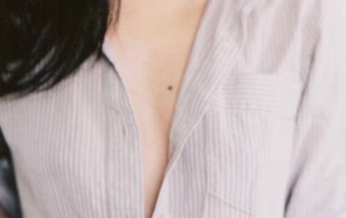 胸上有痣图片:男人女人胸上有痣含义 胸上有痣图片:男人女人胸上有痣含义