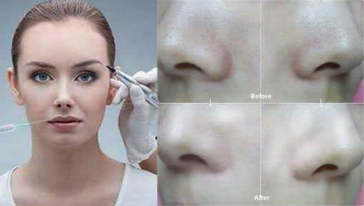 赴韩整容成植物人始末详情:整容的危害大盘点 赴韩整容成植物人始末详情:整容的危害大盘点