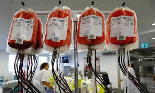 A型血秒变O型血是真的吗:这到底是个什么操作 A型血秒变O型血是真的吗:这到底是个什么操作