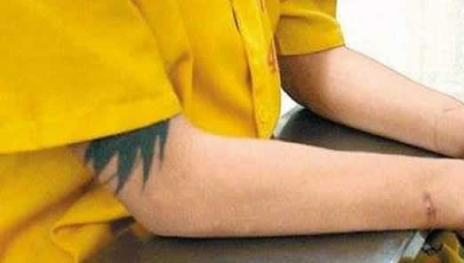 小伙胳膊上纹张脸：详情经过未成年究竟能不能纹身