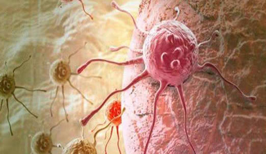 癌症自我毁灭方法:这究竟是怎么回事 癌症自我毁灭方法:这究竟是怎么回事