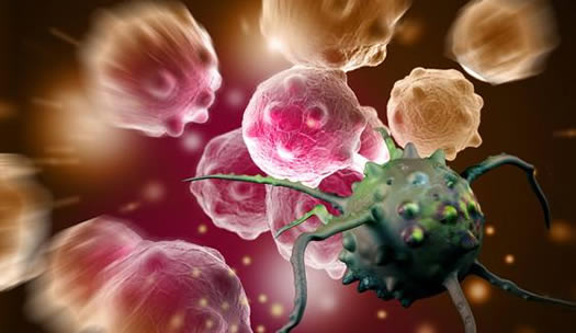 癌症自我毁灭方法:这究竟是怎么回事 癌症自我毁灭方法:这究竟是怎么回事