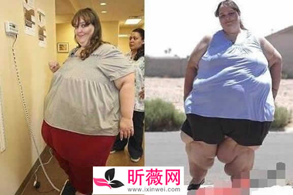 7大世界上最胖的人：有图有真相（最胖人图片）