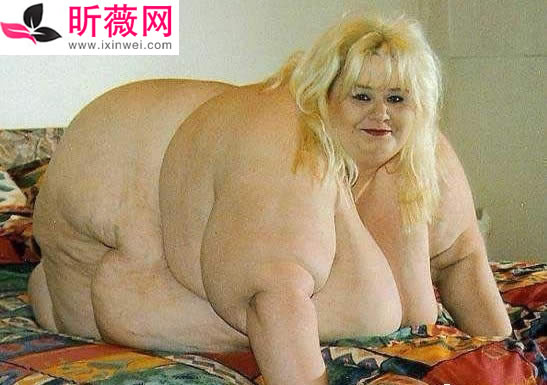 7大世界上最胖的人：有图有真相（最胖人图片）