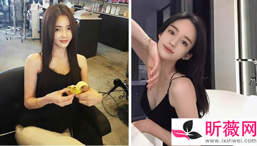 潘南奎以前的样子：潘南奎整容后的美照欣赏