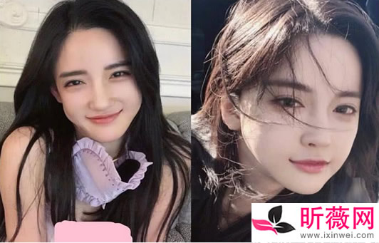 潘南奎以前的样子：潘南奎整容后的美照欣赏