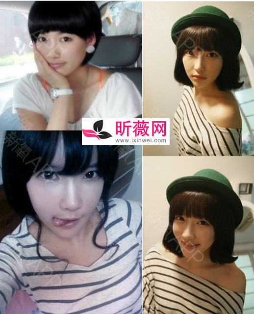 潘南奎以前的样子：潘南奎整容后的美照欣赏