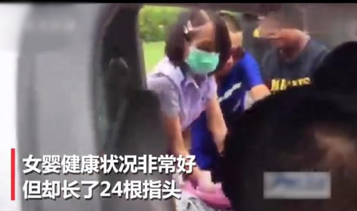 女婴竟有24根指头怎么回事：过程及真相外婆这样说