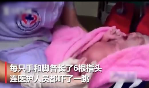 女婴竟有24根指头怎么回事：过程及真相外婆这样说