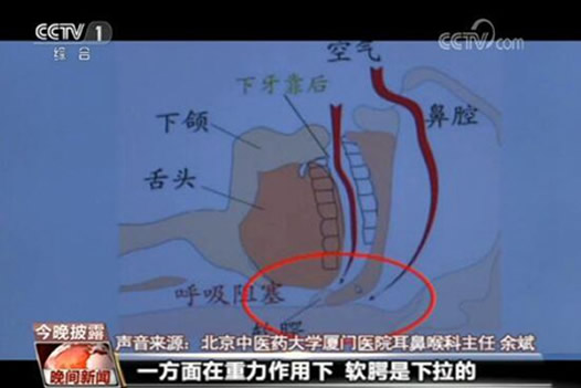 小伙睡觉打呼猝死：真相详情揭晓及打呼噜原因危害