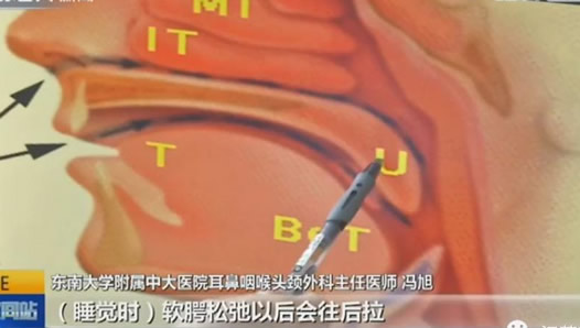 小伙睡觉打呼猝死：真相详情揭晓及打呼噜原因危害