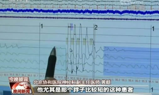 小伙睡觉打呼猝死：真相详情揭晓及打呼噜原因危害